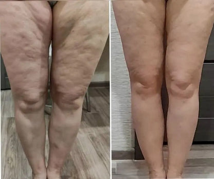 Cryo Thermo™ Gel Firmador