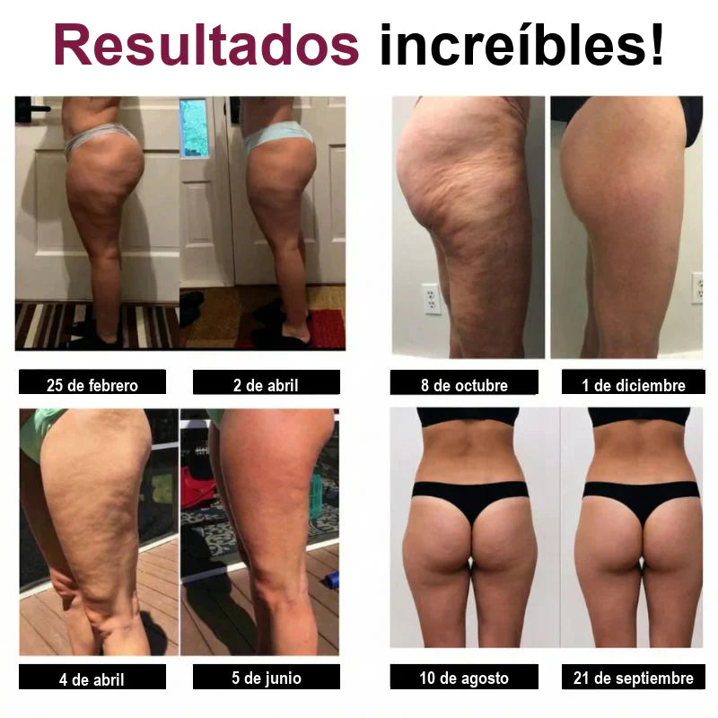 Resultados clientes SculptLab